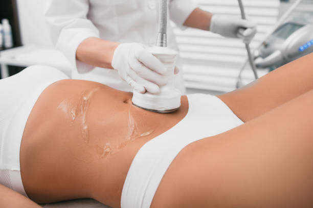 Beautiful woman having a fat removal treatment at beauty clinic