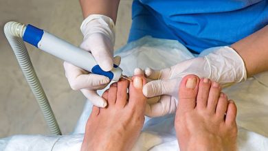 Relief from Ingrown Toenails: Tips for Comfort and Care